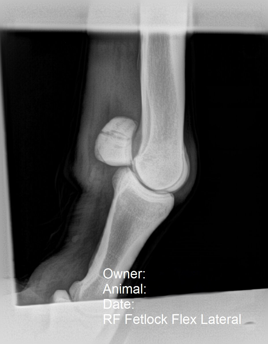 Featured image for “Common Racing Injuries & Their Implications for Performance Careers: Fractures”